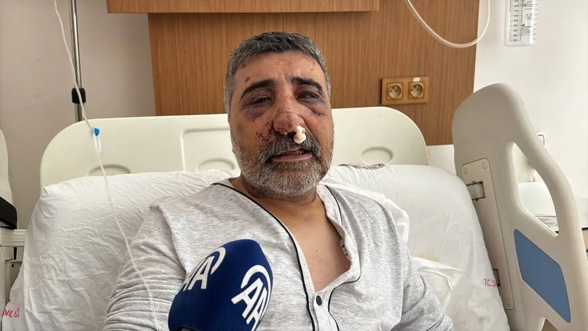 İngiliz Boksör Taksi Şoförünü Darbetti
