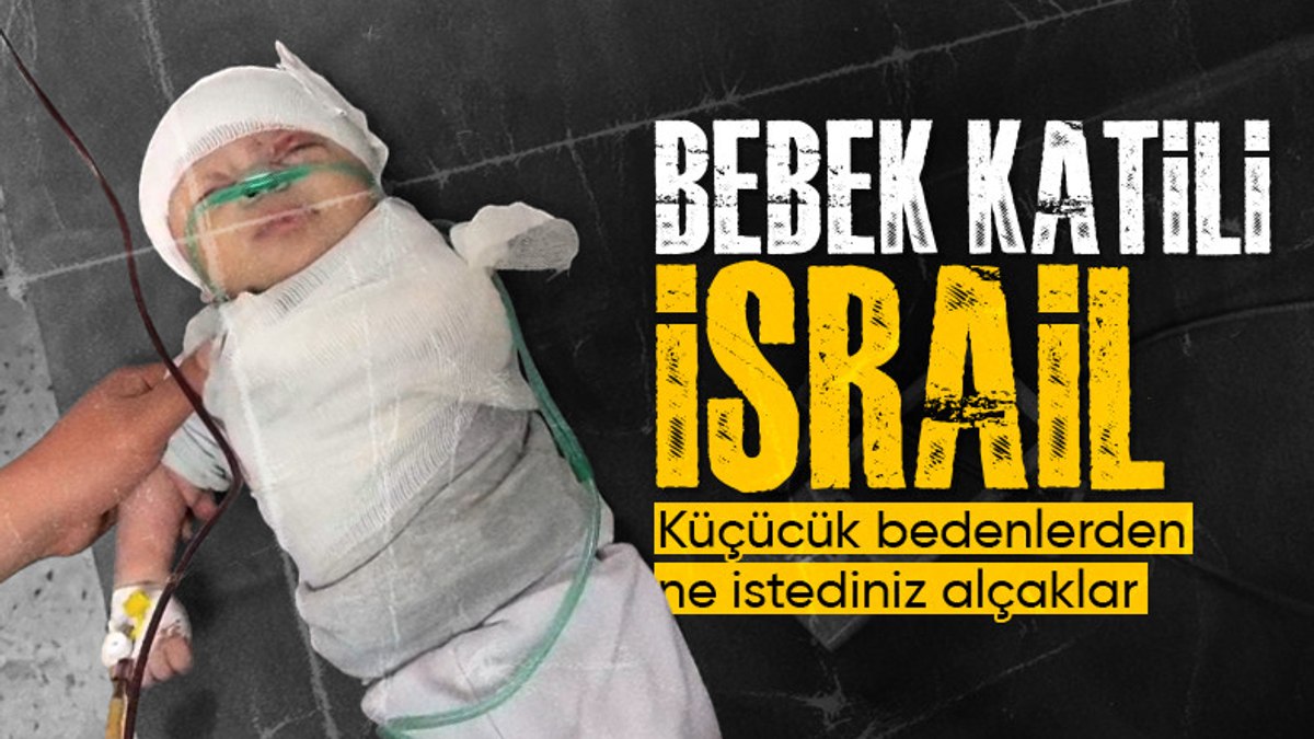 İsrail saldırılarında kolu kopan Gazzeli minik bebek