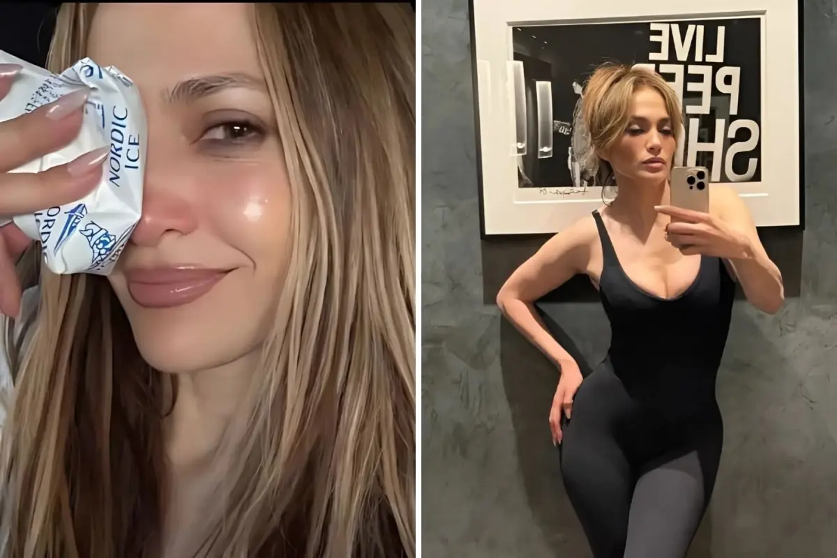 Jennifer Lopez, Amerikan Müzik Ödülleri provaları sırasında yüzünden yaralandı